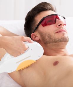 Combinações de Zonas de Depilação Triplo Laser - Homem