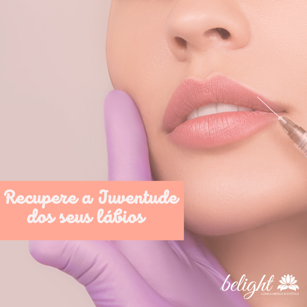 Preenchimento labial.