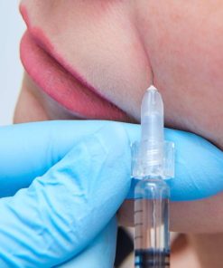 Ácido Hialurónico Bigode Chinês