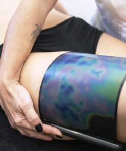 avaliação da celulite